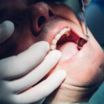 Pierwsza wizyta u dentysty po latach – jak wygląda i jak się przygotować?